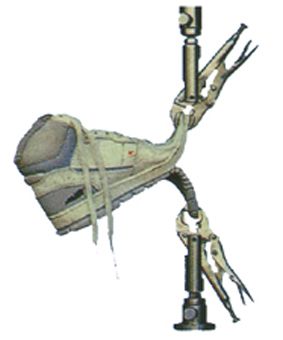 �����C�A���f���Q�A��